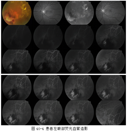ZY016_219_1.gif
